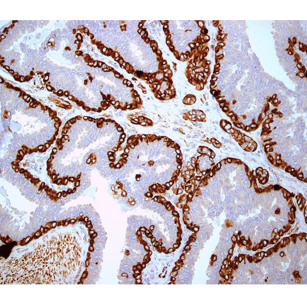 Immunohistochemistry (IHC) | CancerQuest